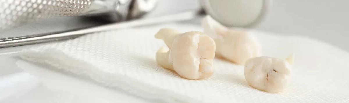Patient consulting with dentist in Brisbane