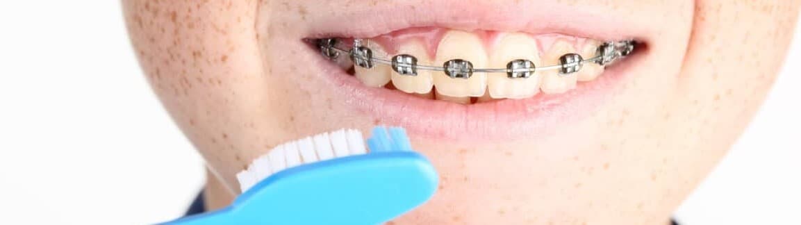 Neatly arranged specialised dental tools on tray.
